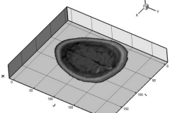 2D Brain Slice