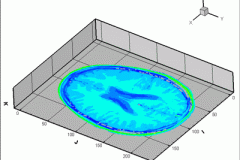 tecplot_animation_brain_slices