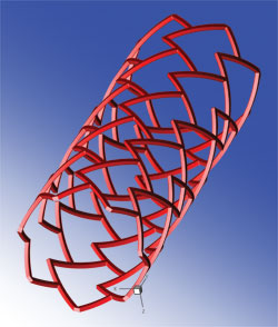 3D model of a stent